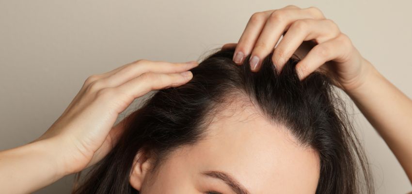 hairline-thinning (4) The woman checks if her hair is regrowing after hairline thinning.